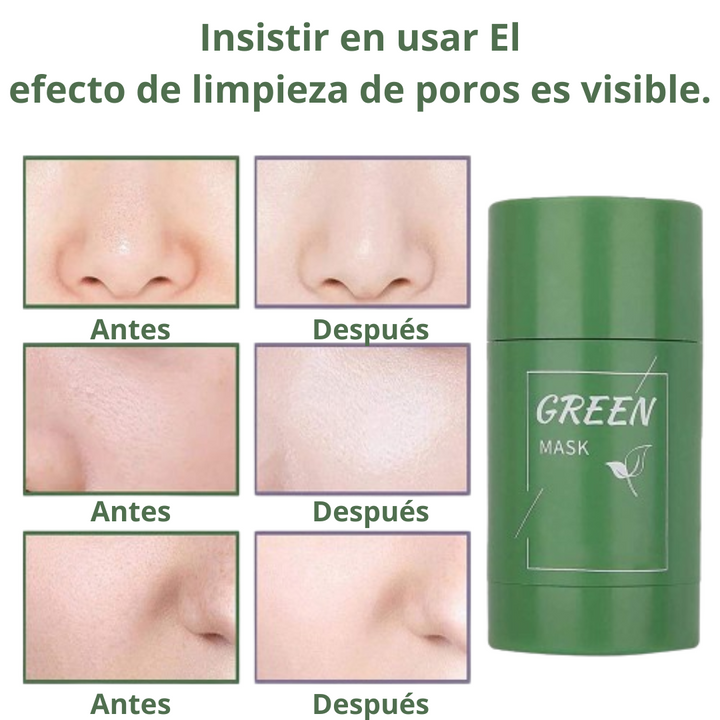 GREEN MASK- REMOVEDOR DE PUNTOS NEGROS 40G